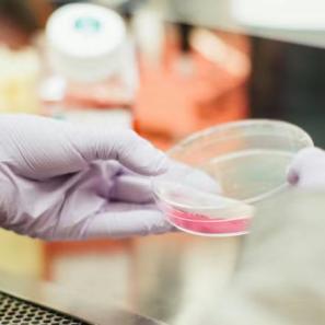 Prokaryotic RNA Sequencing