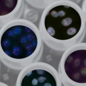 Plasmid Preparation